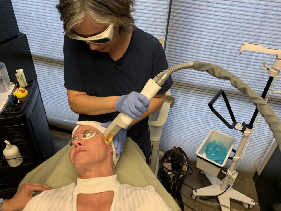 laser genesis facial