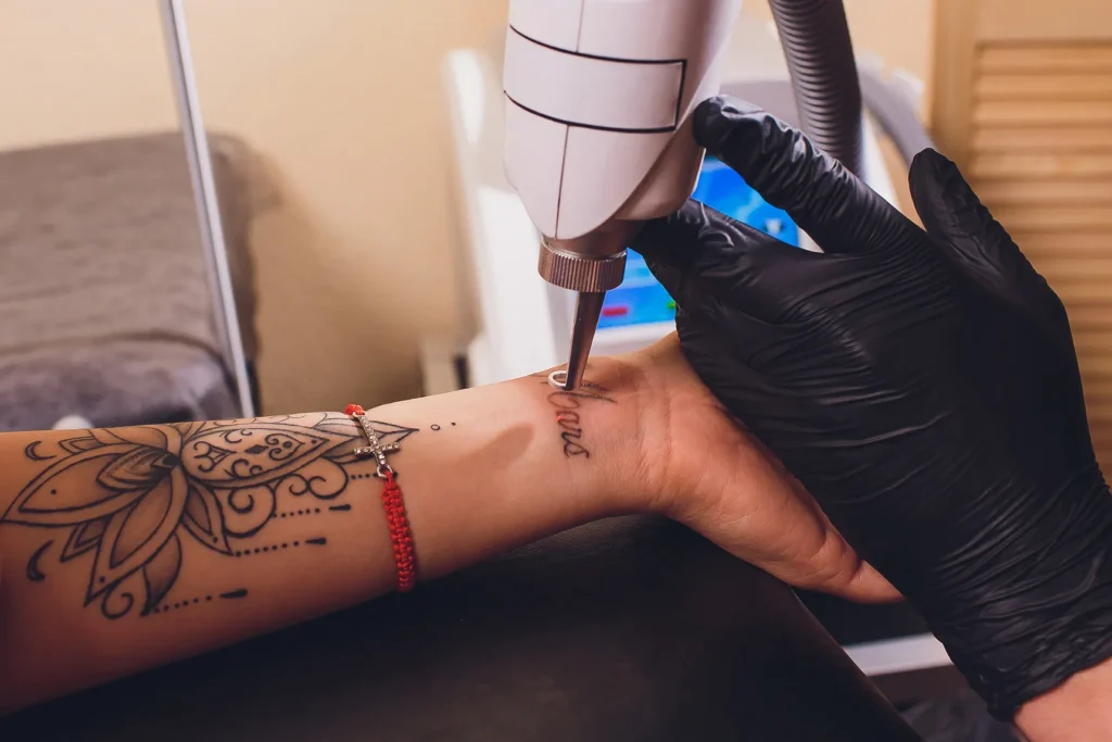 What's in Tattoo Ink?  Collins Cosmetic Clinic