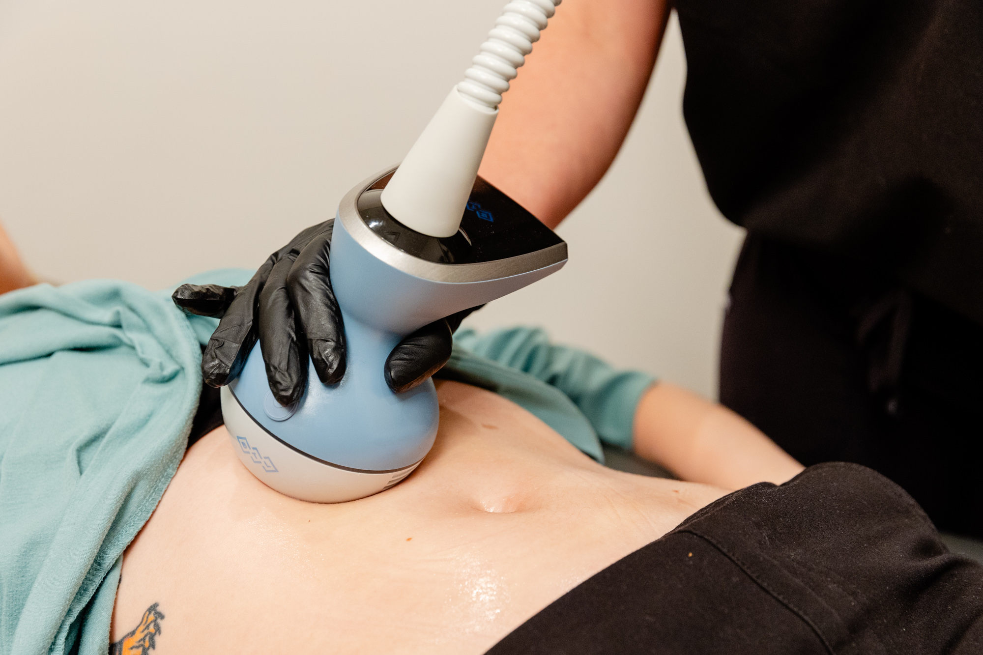 A woman is undergoing treatment with the body applicator for Exion in Fort Collins.