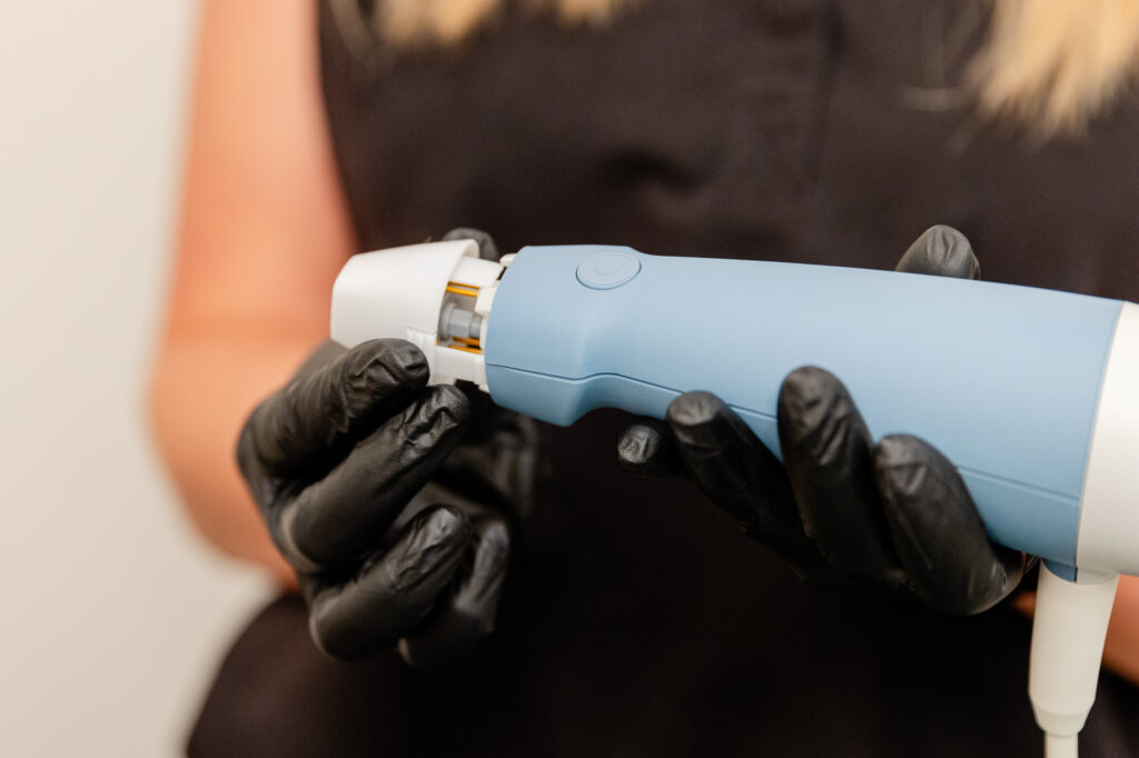 A woman is holding up the RF Microneedling applicator for Exion in Fort Collins.